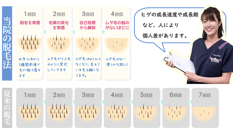 ヒゲの成長速度や成長期など、人により個人差があります。